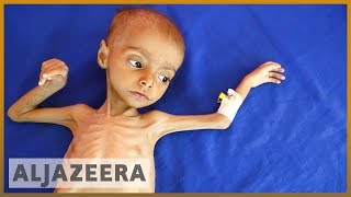 🇾🇪 19 million Yemeni children suffer malnutrition and illness l Al Jazeera English [upl. by Zel761]