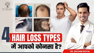 4 Common Hair Loss Types and How to Treat Them हिंदी में  Types of Hair Loss  Dr Shivam Goyal [upl. by Ahsaet323]