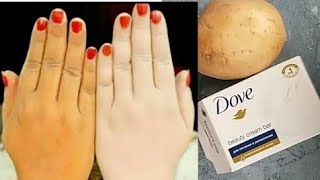 skin whitening potatoDove soap get fair skin in just 3 days [upl. by Kalli]