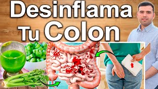 Cómo Desinflamar El Colon  Elimina La Colitis En 3 Pasos [upl. by Lyns]