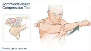 Acromioclavicular Compression Test  Chiropractic Online CE™ [upl. by Alisha]