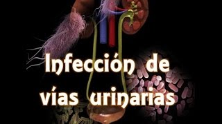 Infección de vías urinarias IVU [upl. by Glendon]