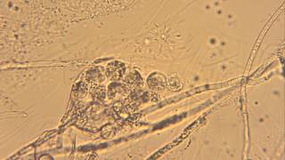 Releasing Oospores from Oogonium Oomycetes [upl. by Sherard]