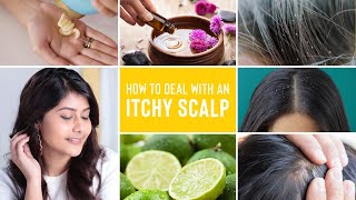 Itchy Scalp Treatments  Remedies For Dandruff Lice and Scalp Acne [upl. by Filia907]