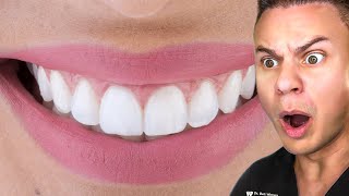 Dentist Reveals Secret To The PERFECT Smile [upl. by Euqina]