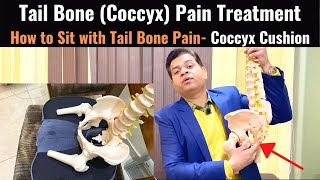 Tailbone Pain Relief Treatment Coccydynia Coccyx Seat Cushion Tail bone Exercises Sitting Pain [upl. by Endys954]