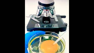 Egg Yolk 🍳 under Microscope 🔬 reactionvideo crazyshorts egg Michael Jackson [upl. by Ajnos]