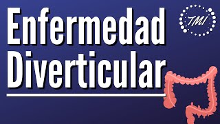 Enfermedad Diverticular Explicada Claramente [upl. by Eelymmij]