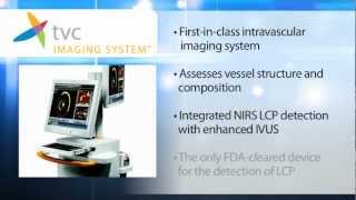 Introduction to the TVC Imaging System™ [upl. by Church]