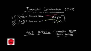 Internuclear ophthalmoplegia INO BASIC amp QUICK EXPLANATION [upl. by Lebyram]