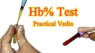 Hemoglobin test Procedure Hb test Method in UrduHindi [upl. by Sandy841]