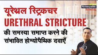 यूरेथ्रल स्ट्रिक्टर  Urethral Stricture  Natural Homeopathic remedies with symptoms होम्योपैथिक [upl. by Ogata]