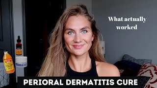 Perioral Dermatitis Treatment [upl. by Gracye687]