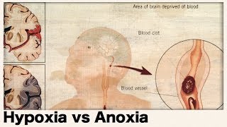 What is the difference between hypoxia and anoxia [upl. by Enilekcaj]