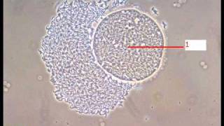 Revision Tp parasitologie n°4 [upl. by Isidro]