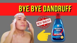 DANDRUFF PAANO MAWALA IN JUST A WEEK  Selsun Blue ProX AntiDandruff Shampoo  Honest Review Tips [upl. by Anerol]