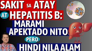 Sakit sa Atay at Hepatitis B Marami Apektado Pero Hindi Nila Alam By Doc Willie Ong [upl. by Ardath722]