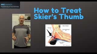 How to Treat Skiers Thumb [upl. by Akenihs]