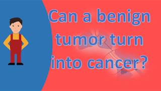 Can a benign tumor turn into cancer  Best Health Answers [upl. by Gnov]