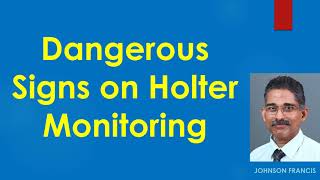 Dangerous Signs on Holter Monitoring [upl. by Sukramaj]