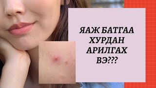 БАТГАА ЯАЖ ХУРДАН ХУГАЦААНД АРИЛГАХ ВЭ  QUICK BLEMISH CARE FOR ACNE PRONE SKIN TYPE [upl. by Okiram]