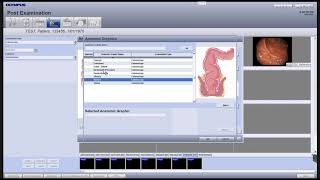 12  Adding Anatomical Graphics in Endobase [upl. by Bouley675]