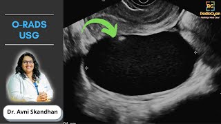 Demystifying ORADS  Ultrasound  Dr Avni Skandhan  July 2021 [upl. by Tamma]