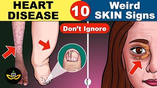 10 Unexpected Signs of Heart Disease that you Must Know [upl. by Jamil]