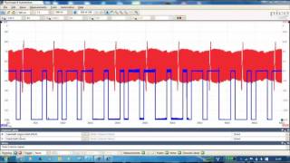 Testing the Cam and crank sensors [upl. by Tali]