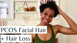 PCOS Facial Hair and Hair Loss  Causes Treatments amp Natural Ways to Reduce Hirsutism amp Hair Loss [upl. by Itoc743]