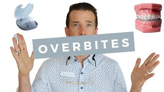 Overbite vs Overjet Whats The Difference  Dr Nathan  Orthodontist [upl. by Ennoved752]