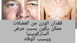 لو بتفقد وزن من عضلاتك فاحتمال يكون عندك مرض خطير اسمه sarcopenia [upl. by Quentin378]