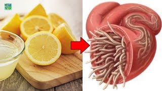 Lemon Recipe To Eliminate Parasites And Body Fat  Home Remedies [upl. by Shugart]