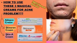 How To Use Adapco Skinoren and Skin A Cream  How To Apply Adapco Skin A and Skinoren Cream [upl. by Naig]