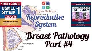 Breast pathologyCancer from Pathoma in urdu Part4 Reproductive system pathUrduHindi [upl. by Sprung]