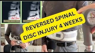 REVERSE BACK PAIN IN 4 WEEKS 131  wwwdrstephenstokescom [upl. by Rosemaria]