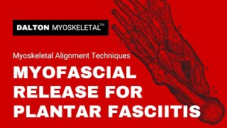 Deep Tissue Myofascial Release Plantar Fasciitis Treatment [upl. by Retsek37]