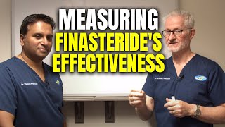 Measuring Outcomes of Finasteride  The Hair Loss Show [upl. by Ailhad]