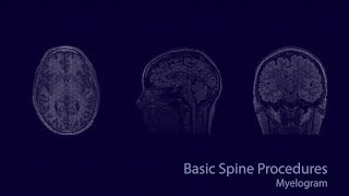 Basic neuroradiology procedures part 3  Myelogram [upl. by Eyr]