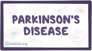 Parkinsons disease  an Osmosis Preview [upl. by Anailil]