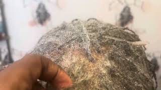 Karen Four Weeks of Extreme Hair Growth 725 sisterlock microlocs hairforthejourney [upl. by Kra]