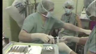 Hospital Dentistry Using General Anesthesia [upl. by Retla936]