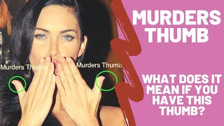 Murders Thumb – What Does it Mean if You Have a Clubbed Thumb Brachydactyly – Hand Analysis [upl. by Eineg961]