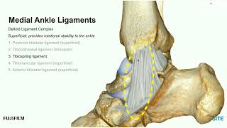 Webinar Using Ultrasound to Evaluate the Medial Ankle [upl. by Donnamarie]