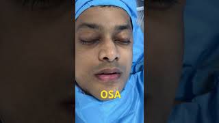 Best OSA Snoring Corrective Surgery for this physician patient from Singapore [upl. by Mount283]