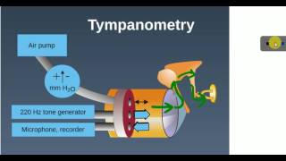 ENT LECTURES  Investigations  TYMPANOMETRY [upl. by Atled960]