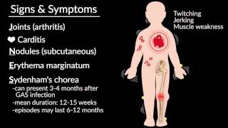 Acute Rheumatic Fever by E Rusingiza  OPENPediatrics [upl. by Ognimod]