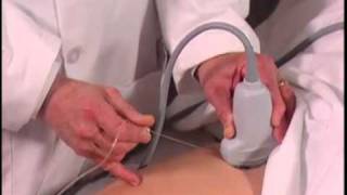 How To Ultrasound Guided Hip Injection Scanning Technique Video [upl. by Lubbock]