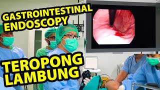 Teropong Lambung amp Usus  GastroIntestinal Endoscopy  dr Dede Budiman SpPD MKes [upl. by Tihw]