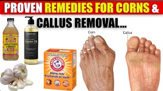 14 Proven Home Remedies For Corns amp Callus Removal THAT WORK  Natural Foot Care Tips  Amazing Tips [upl. by Ylen]